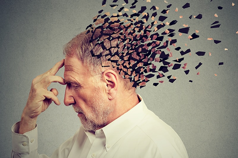 Alzheimer